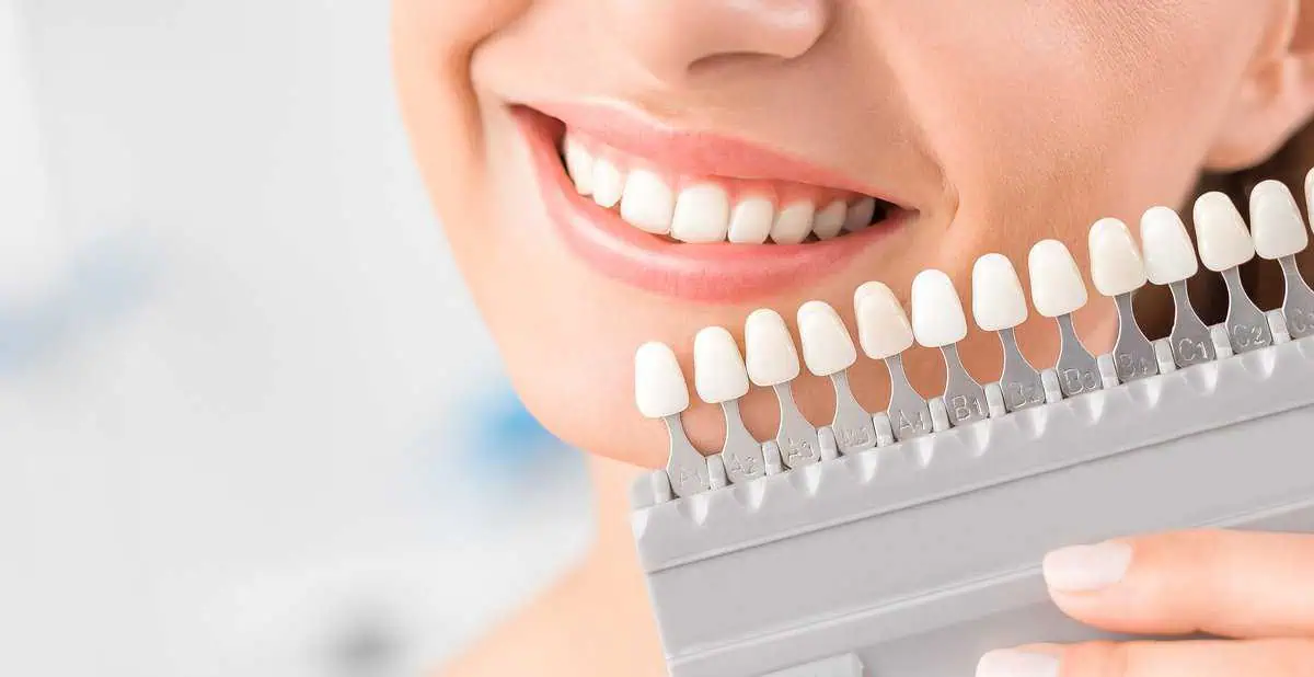 Teeth Whitening in Helena, MT by Fyre Aesthetics