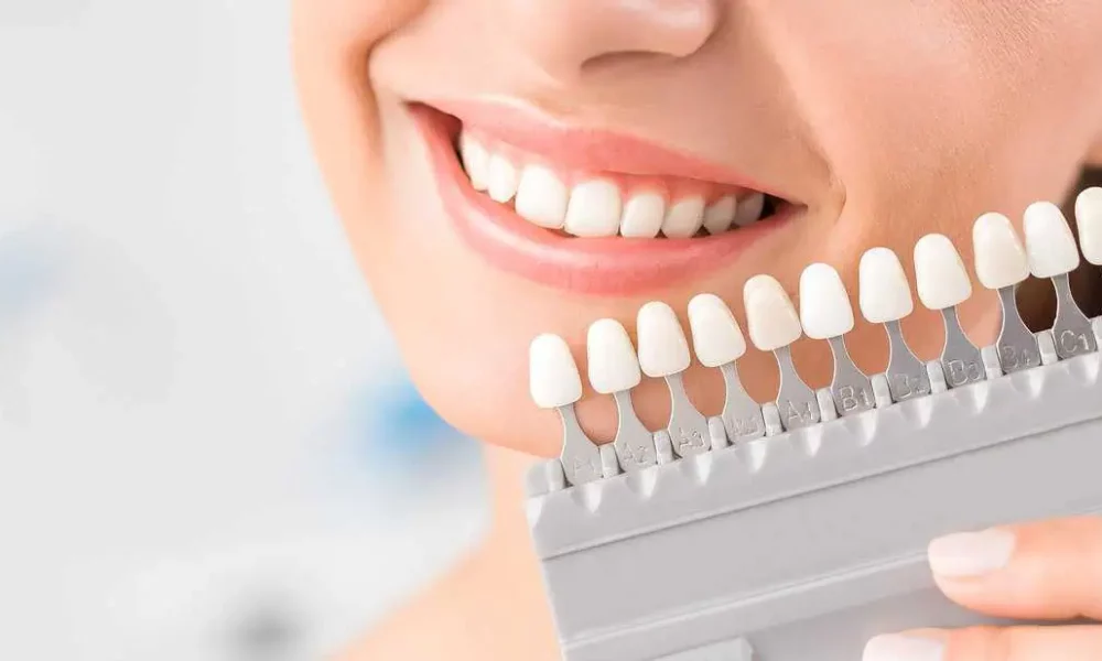 Teeth Whitening in Helena, MT by Fyre Aesthetics