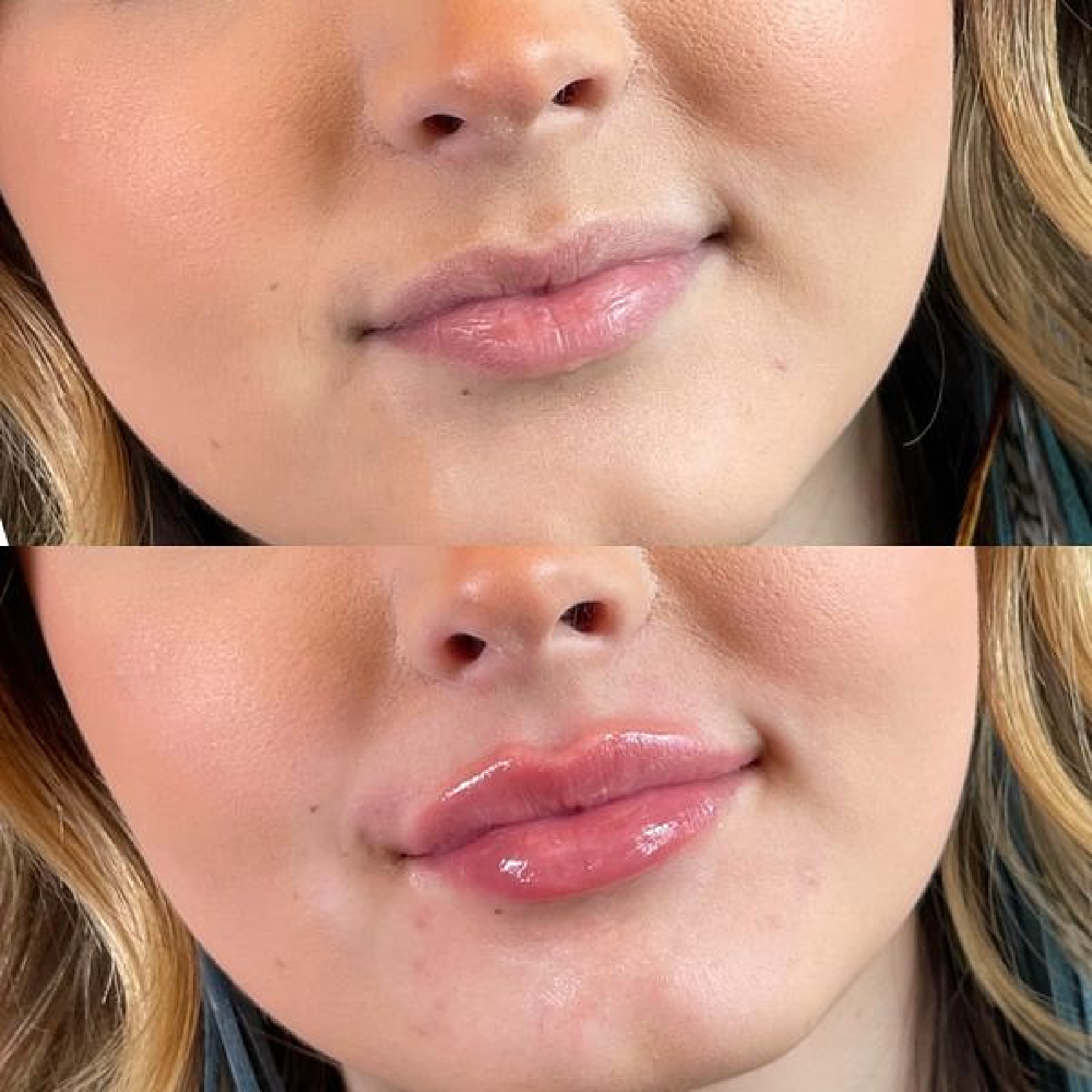 Gallery Filler Image Four In Helena MT | Fyre Aesthetics