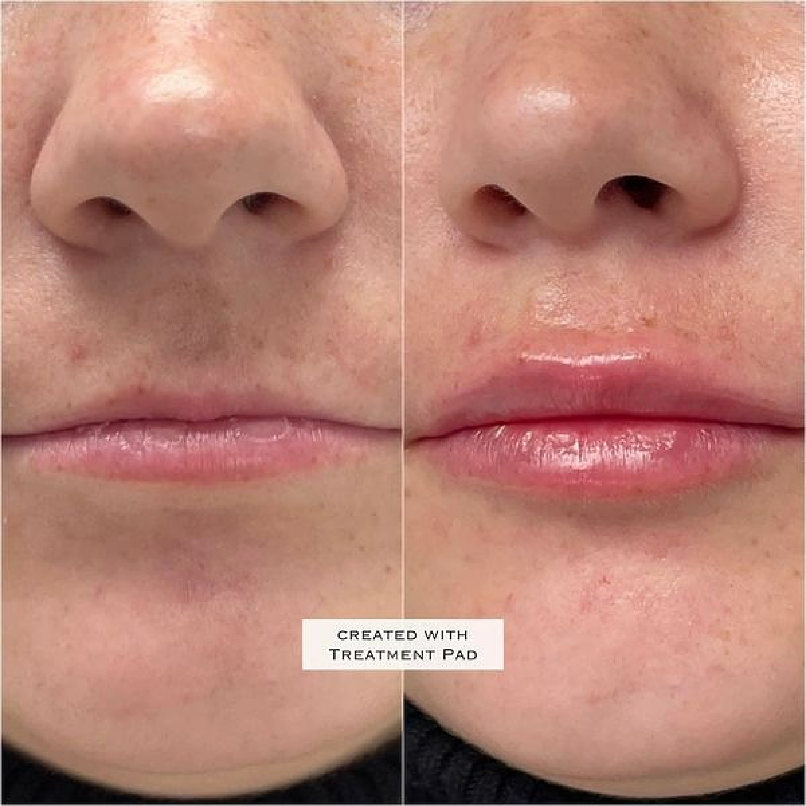 Gallery Filler Image Six In Helena MT | Fyre Aesthetics