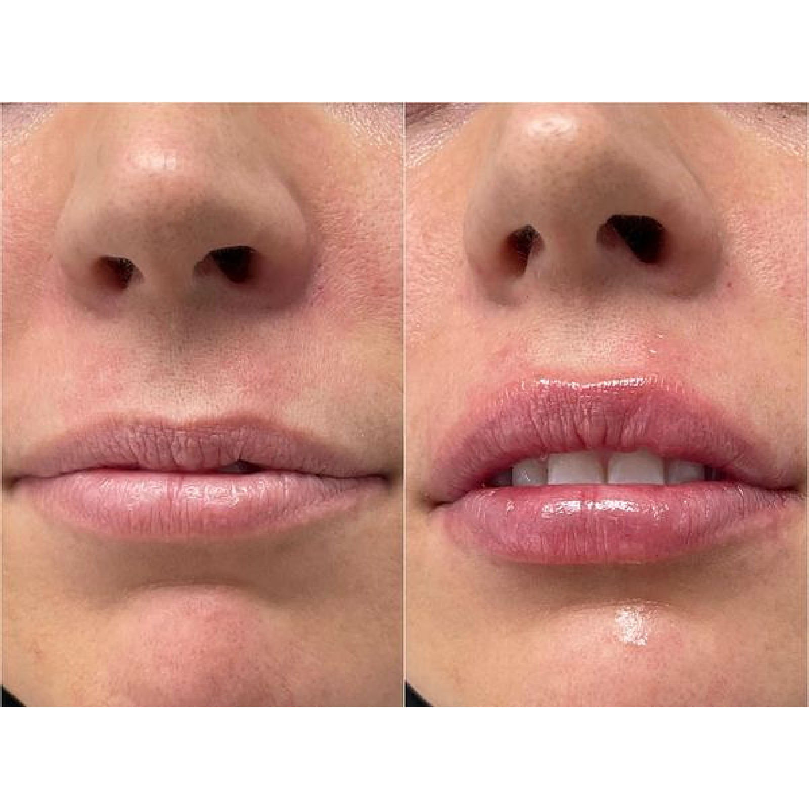 Gallery Filler Image Three In Helena MT | Fyre Aesthetics
