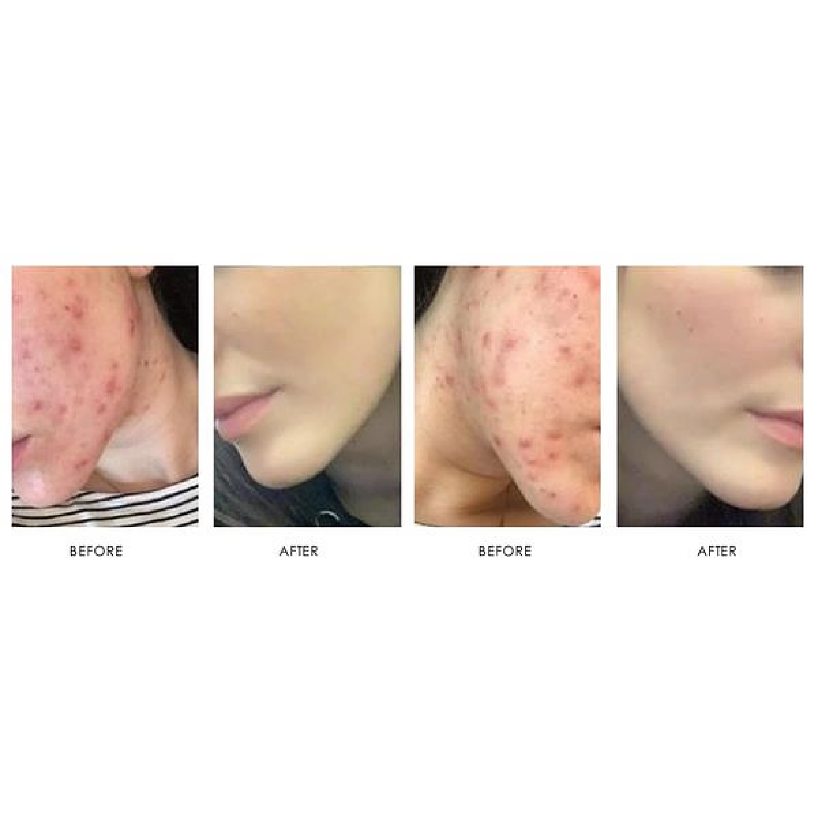 Gallery Laser Image Thirty In Helena MT | Fyre Aesthetics