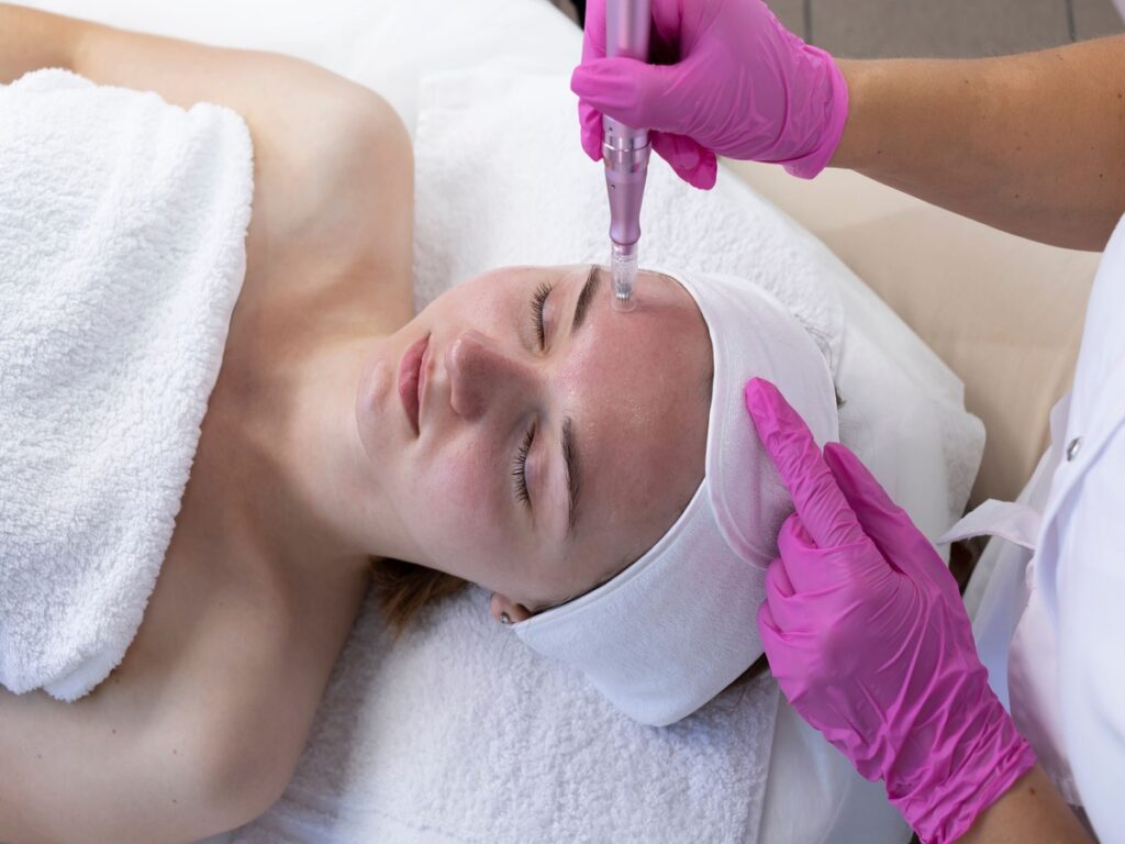 Microneedling by Fyre Aesthetics in Helena MT