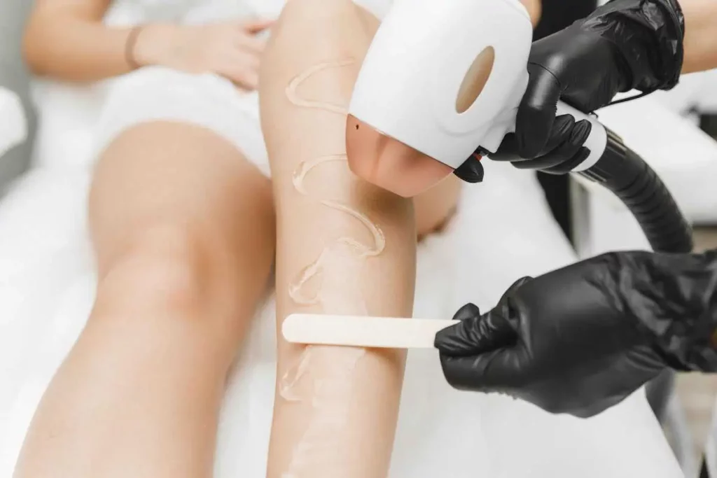 Laser Hair Remval by Fyre Aesthetics in Helena MT