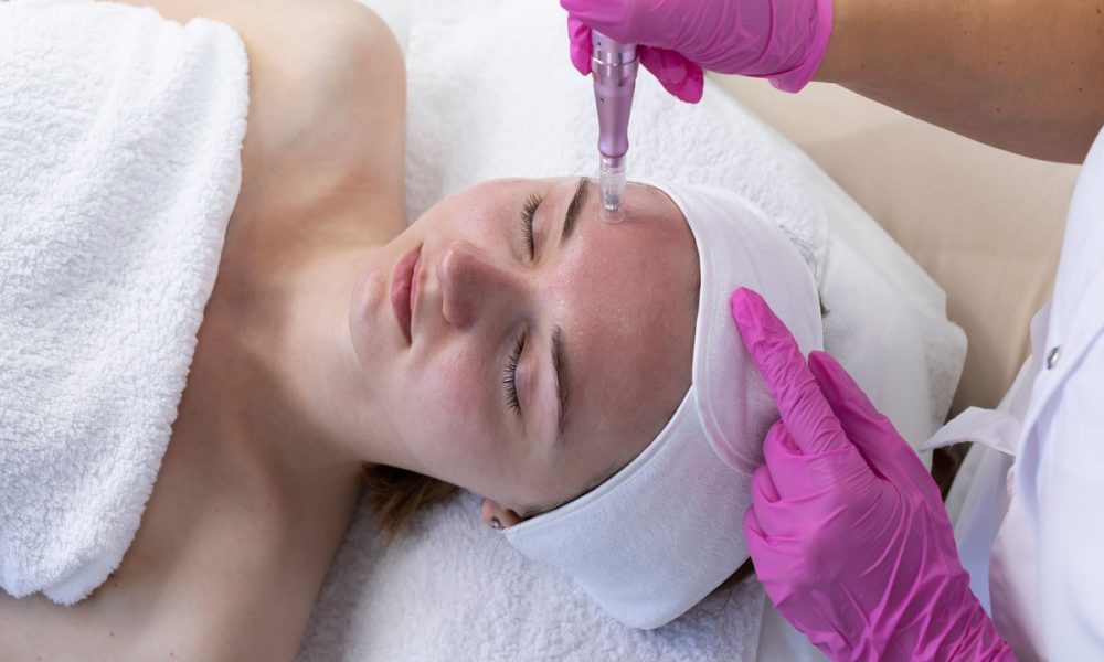 Microneedling by Fyre Aesthetics in Helena MT